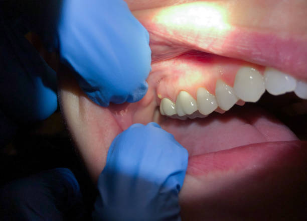 Best Weekend Emergency Dentist in Trinity, TX