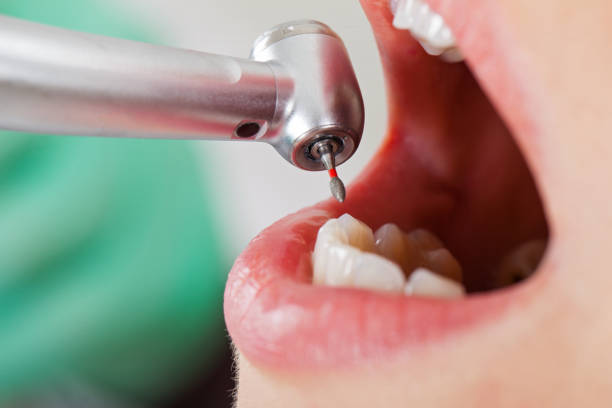 Best Emergency Dental Surgery in Trinity, TX